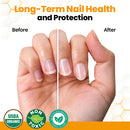 Óleo revitalizante antifúngico para unhas com veneno de abelha