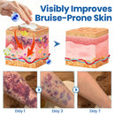 Pele Frágil Timilk® 🛡️🌿 Multireparação para Hematomas, Ressecamento e Manchas
