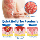 Pele Frágil Timilk® 🛡️🌿 Multireparação para Hematomas, Ressecamento e Manchas