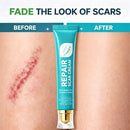 RepairCream - Gel de silicone para reparação de cicatrizes
