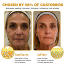 Creme Firmador Antirrugas, para Linhas do Pescoço e Pés de Galinha