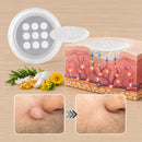 ✨ShapeOil® Adesivo 2 em 1 com Microagulhas e Hidrocoloide🍀 | Remove Verrugas Salientes, Acne, Verrugas Planas e Marcas de Pele | Ajuda a Melhorar Rugas, Cicatrizes e Imperfeições | Adesivos Invisíveis para Rosto e Corpo