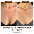Silk Body Oil – Firma, levanta, suaviza e reduz rugas.