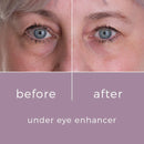 Under Eye Enhancer - Acabe com olheiras, rugas, pés de galinha em 60 segundos