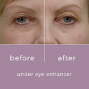 Under Eye Enhancer - Acabe com olheiras, rugas, pés de galinha em 60 segundos