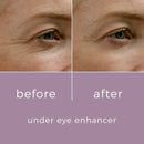 Under Eye Enhancer - Acabe com olheiras, rugas, pés de galinha em 60 segundos