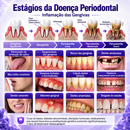 Gingivitis – Gel Reparador Avançado para Gengivas