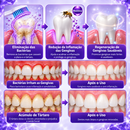 Gingivitis – Gel Reparador Avançado para Gengivas