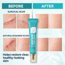 RepairCream - Gel de silicone para reparação de cicatrizes