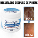 GentX Relief Cream (Creme contra verrugas, HPV, eczema, coceira e irritação.)