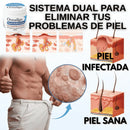 GentX Relief Cream (Creme contra verrugas, HPV, eczema, coceira e irritação.)