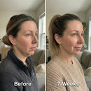 Face Sculpt Wrap - Tecnologia Termogênica para Mandíbulas definidas sem cirurgia