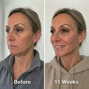 Face Sculpt Wrap - Tecnologia Termogênica para Mandíbulas definidas sem cirurgia