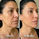 Face Sculpt Wrap - Tecnologia Termogênica para Mandíbulas definidas sem cirurgia