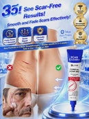 ScarSil - Gel de silicone para reparação de cicatrizes